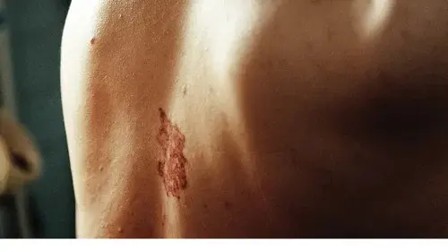 Original Wound
