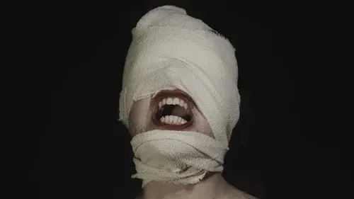 The Bite