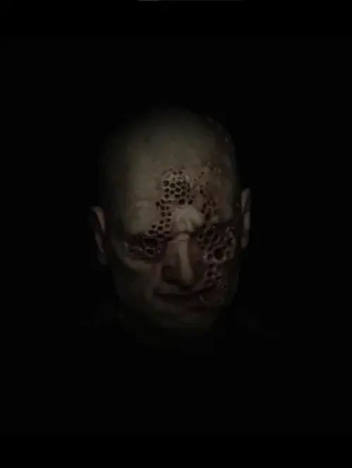 Trypophobia