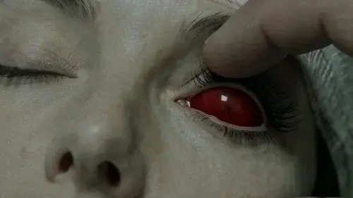 They Lurk Beneath Eyelids